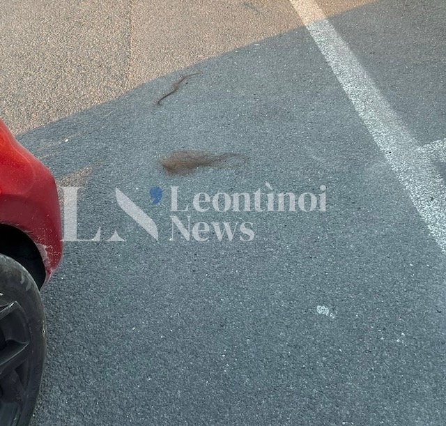 Lentini, 15enne picchiata da una coetanea finisce in ospedale